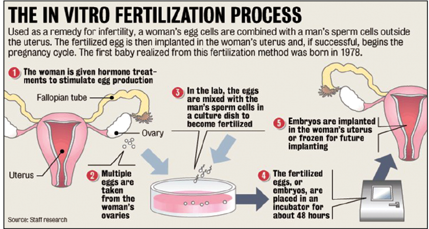 IVF process