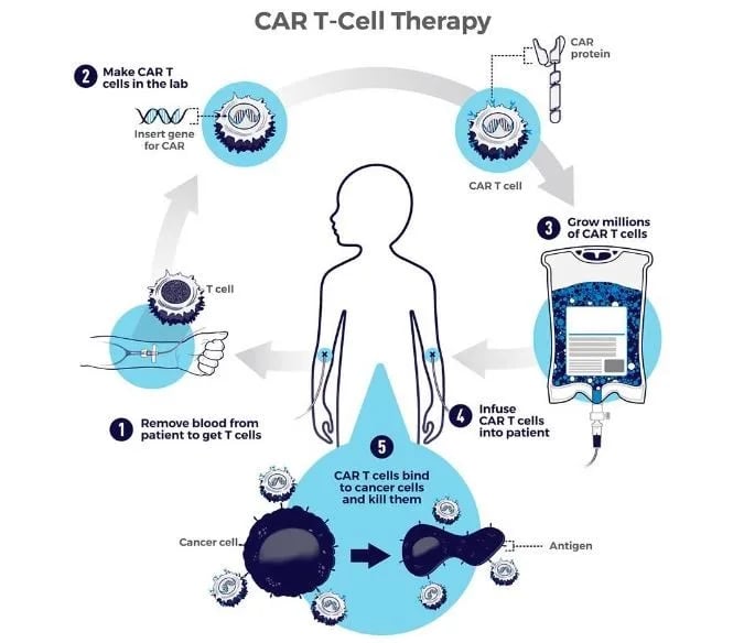 CAR T-cell Therapy